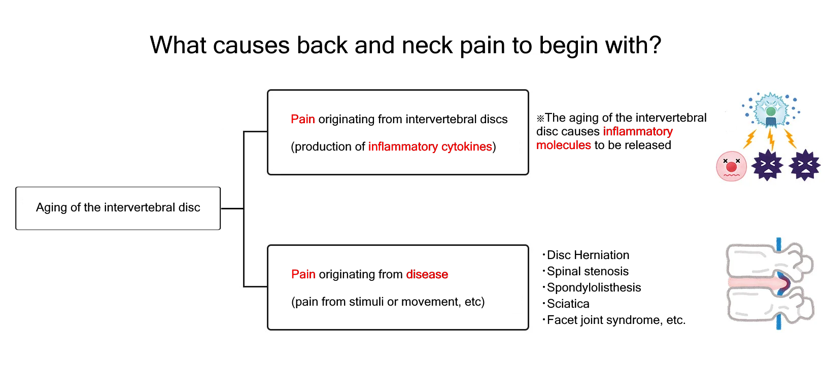 causes of back pain