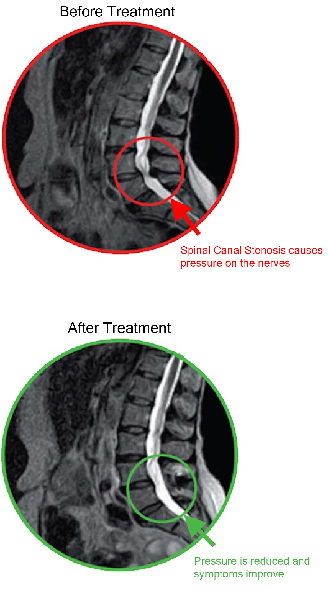 X-rays before and after Florence method treatment