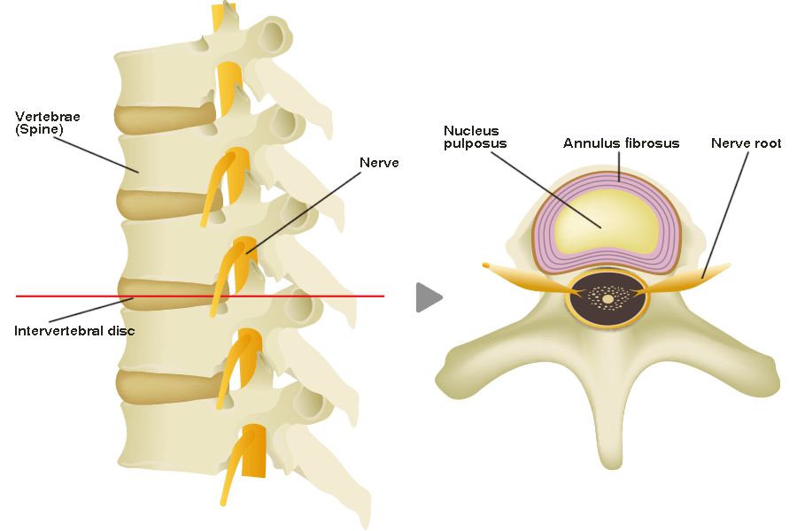 intervertebral disc