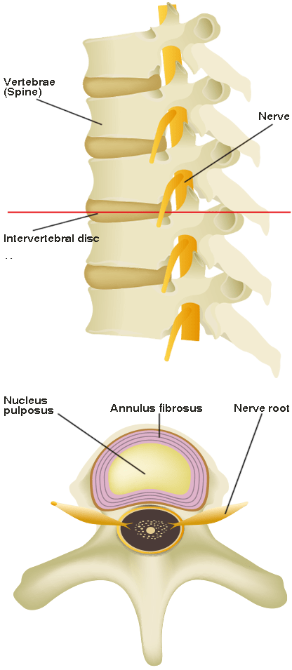 intervertebral disc