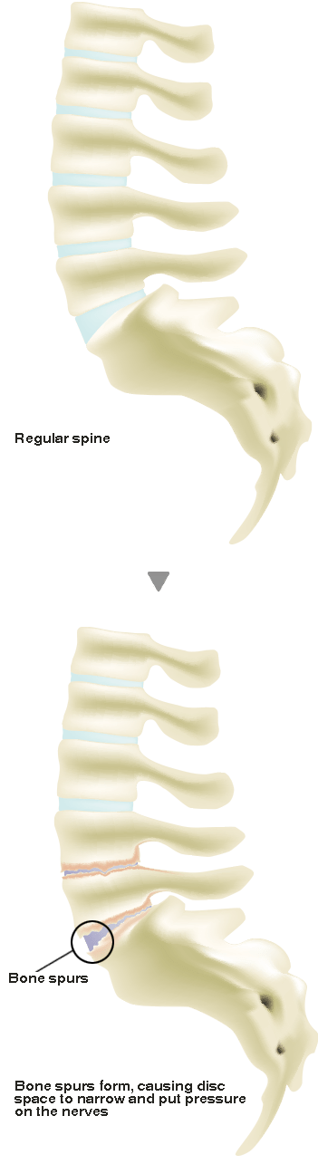 intervertebral disc