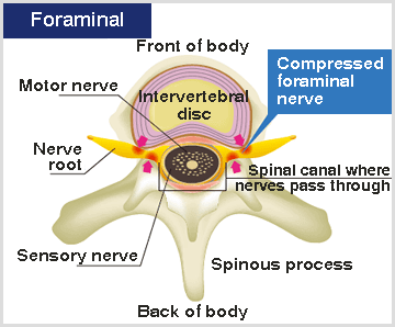 nerve root image