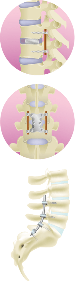 Treatment image of the cell-gel method