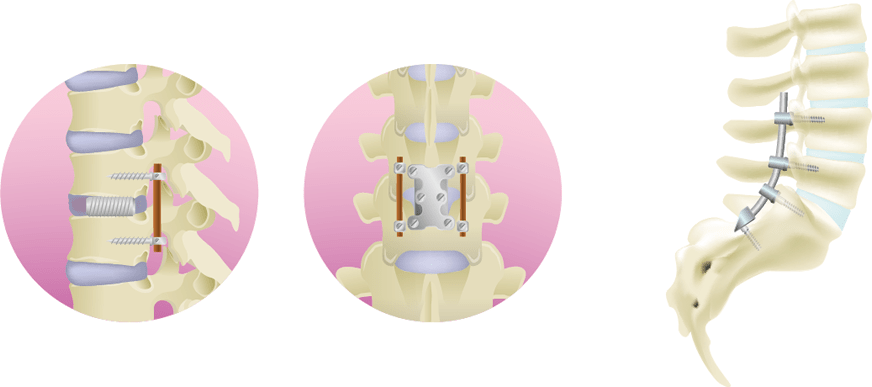 Treatment image of the cell-gel method