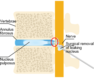Treatment image of the cellgel method