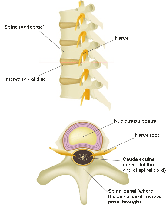 Image of spinal canal stenosis
