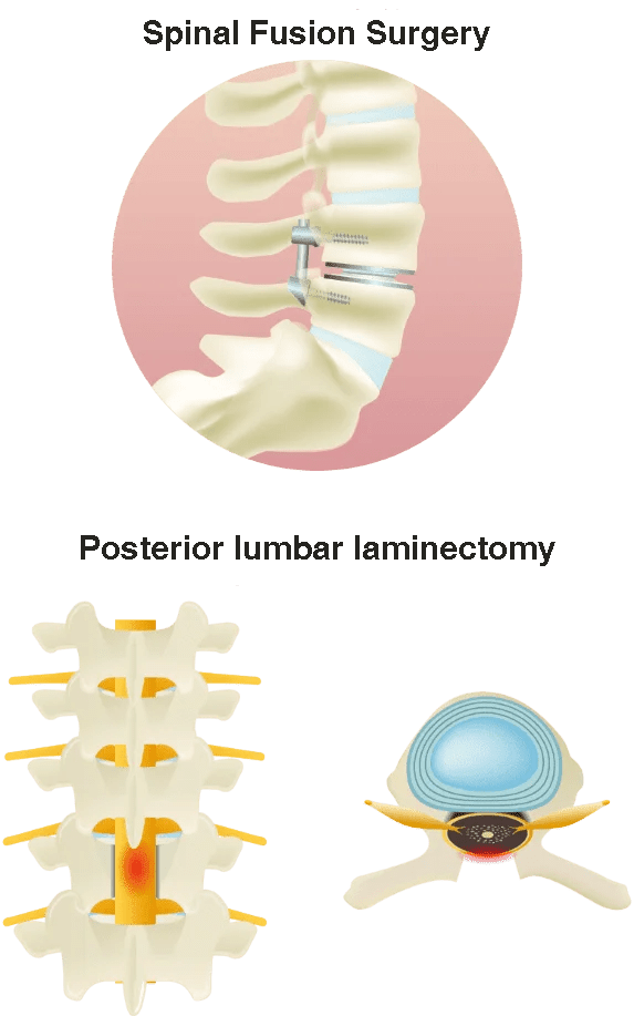 Conventional treatment image