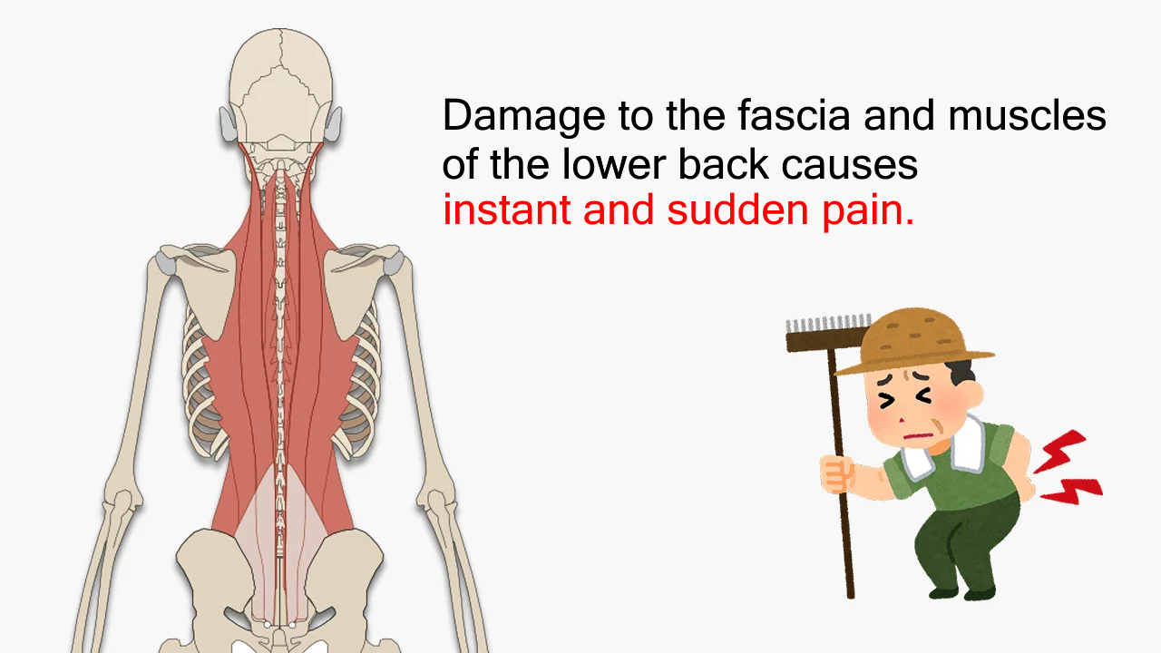 Sudden pain occurs instantly due to damage to the fascia and muscles of the lower back
